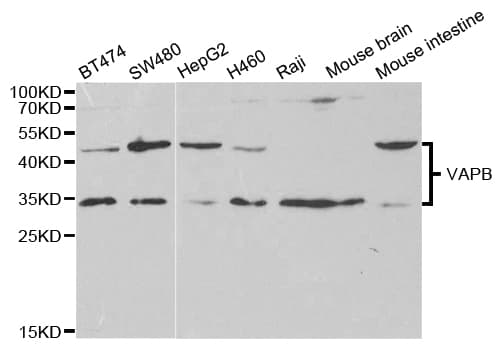 VAPB Antibody
