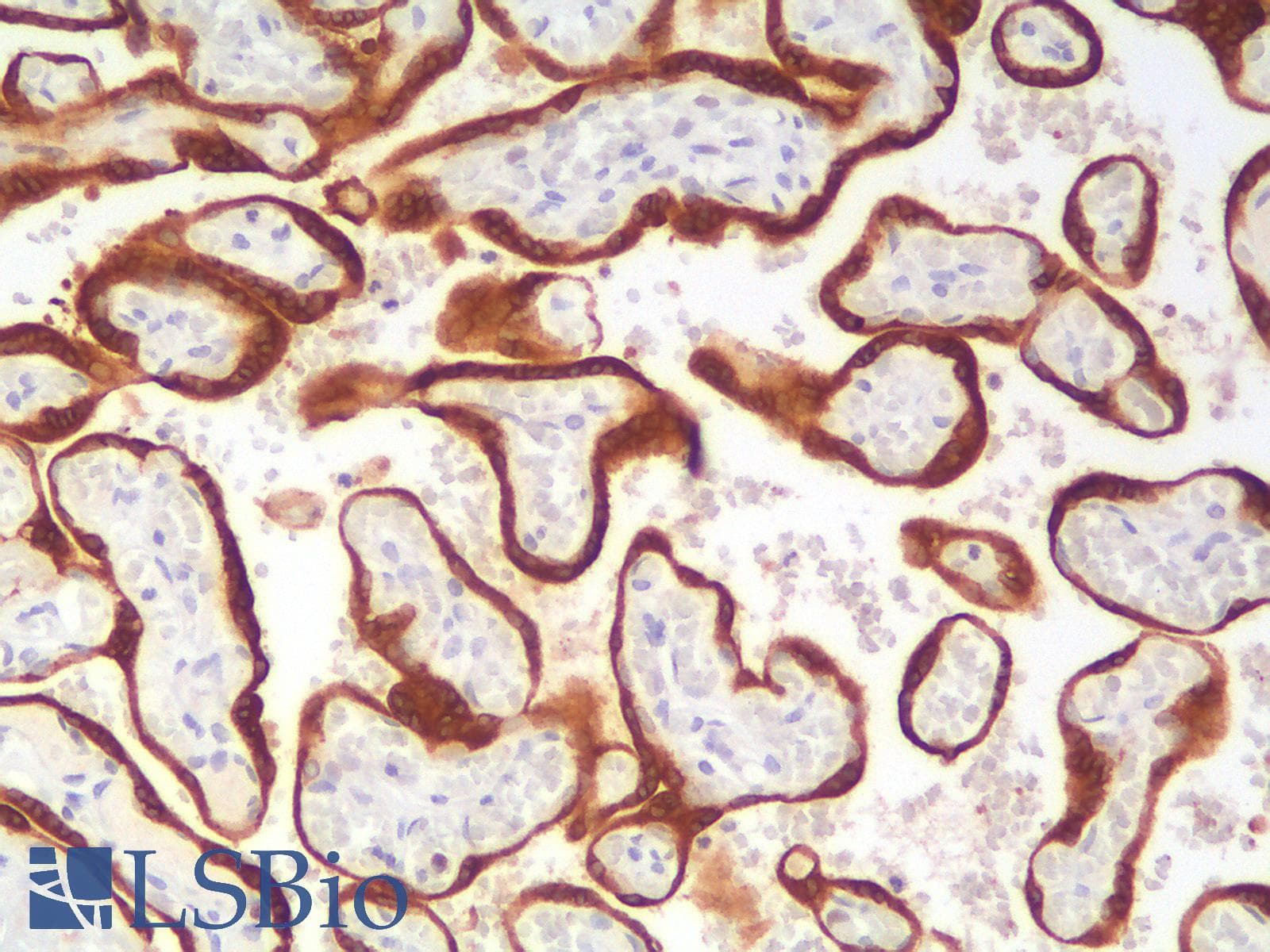 PathPlus™ BCL2 / Bcl-2 Antibody (clone rBCL2/796)