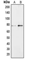 Polyclonal Rabbit anti-Human BRF1 Antibody (Internal, IHC, IF, WB)
