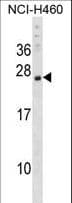 CSRP3 Antibody (aa91-119)