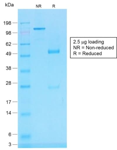 PathPlus™ CD45 / LCA Antibody (clone PTPRC/1783R)