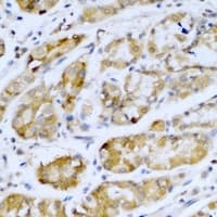 SETD5 Antibody