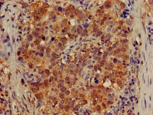 APG4B / ATG4B Antibody