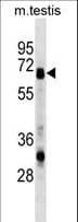 Polyclonal Rabbit anti-Human ASNS Antibody (aa120-147, WB)