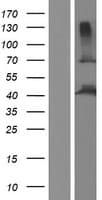 POC1A / SOFT Protein (Over-Expression Lysate Myc-DDK (Flag))
