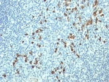 Mouse Anti-Human Lambda Light Chain Secondary Antibody (clone HP6054)