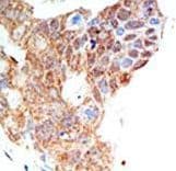 Polyclonal Rabbit anti-Human PRMT5 Antibody (aa591-621, IHC, WB)