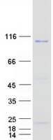 Human PITRM1 / MP1 Protein (Recombinant Myc-DDK (Flag))