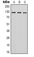 SREBF1 / SREBP-1 Antibody (Internal)