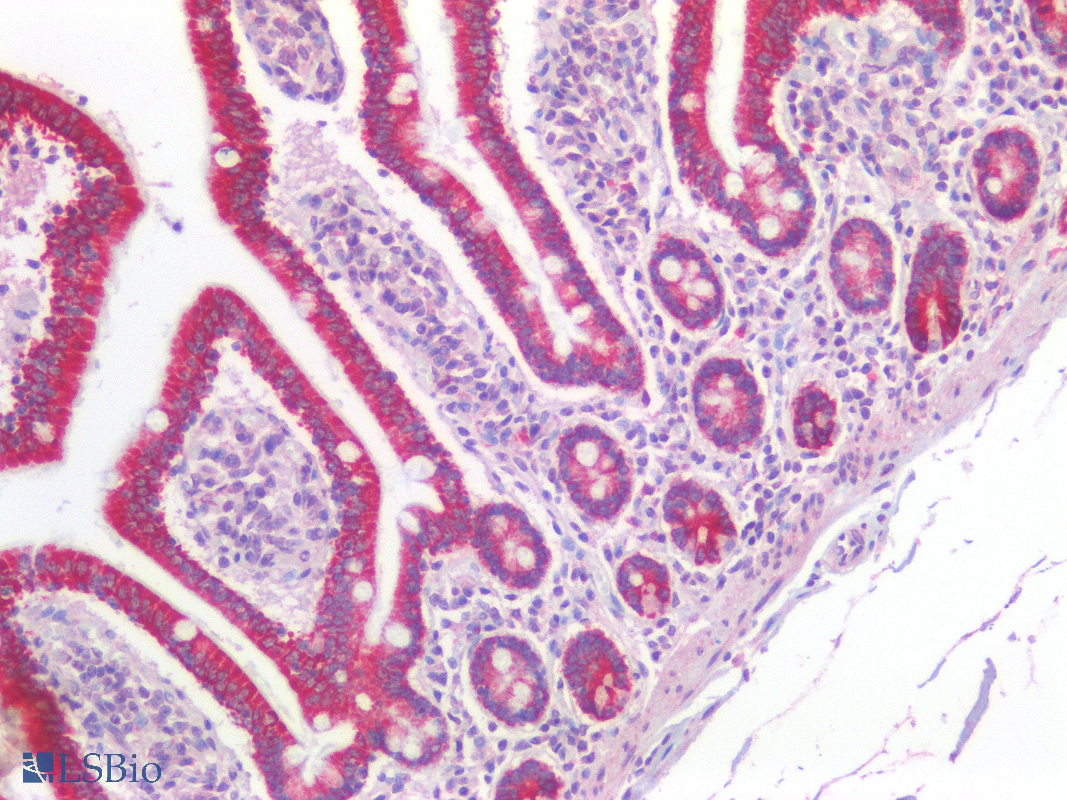 PathPlus™ Polyclonal Rabbit anti-Human TJP1 / ZO-1 Antibody (IHC)