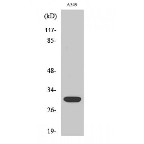 Polyclonal Rabbit anti-Human SIAH1/SIAH2 Antibody (160-240 aa, Internal, IHC, IF, WB)