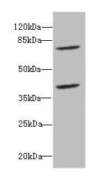 CBFA2T2 / MTGR1 Antibody