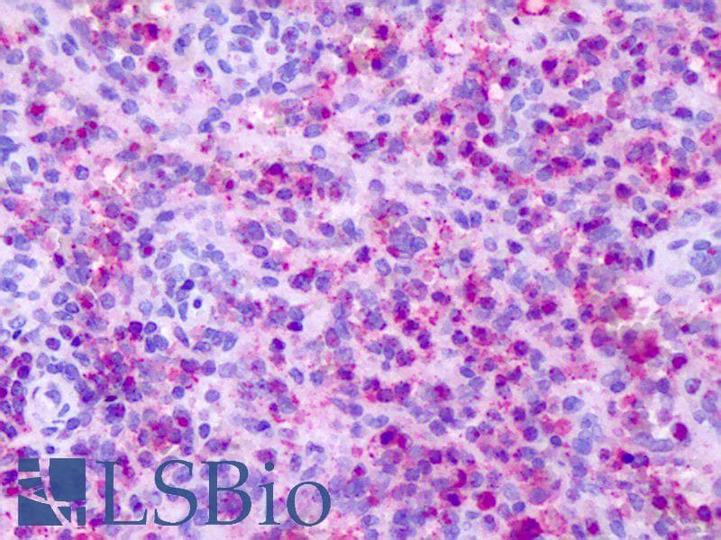 IHC-plus™ CXCR1 Antibody (C-Terminus)