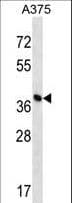 Polyclonal Rabbit anti-Human OVCA1 / DPH1 Antibody (aa384-412, WB)