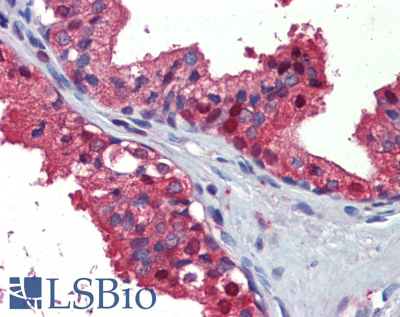 IHC-plus™ Monoclonal Mouse anti-Human ACLY / ATP Citrate Lyase Antibody (clone 3G8, IHC, IF, WB)