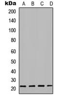 TNNT1 / TNT Antibody (Internal)