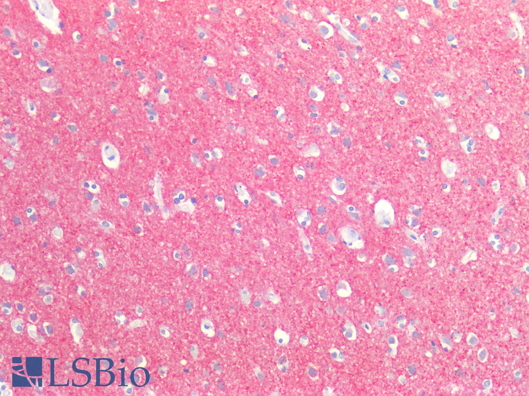PathPlus™ SNAP25 Antibody (C-Terminus)