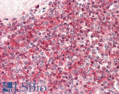 IHC-plus™ SSH3 Antibody (aa340-389)