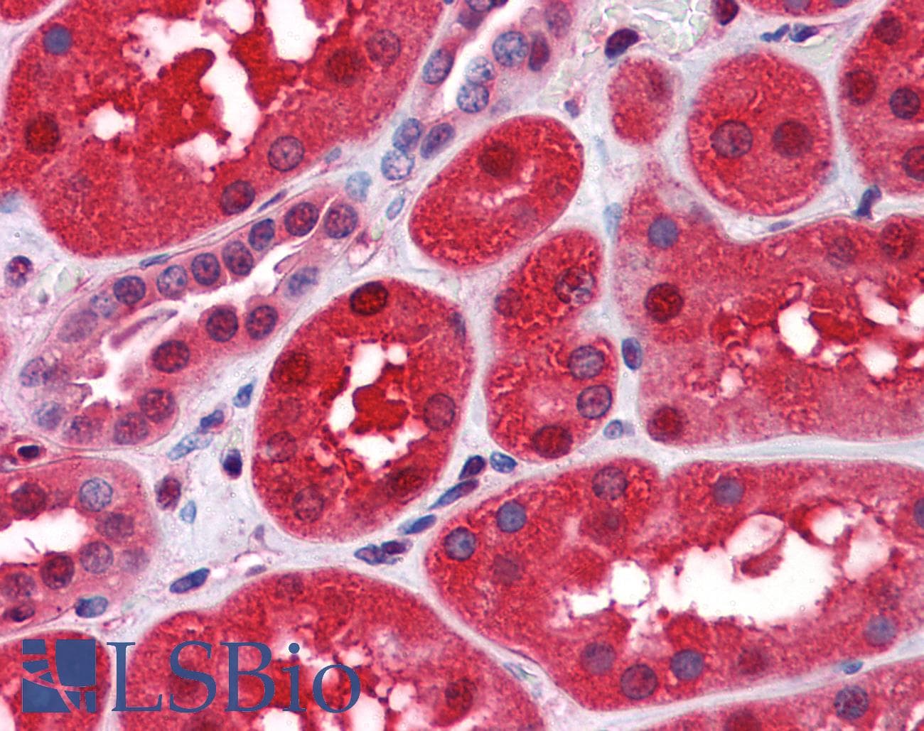 IHC-plus™ Monoclonal Mouse anti-Human CLIC1 / NCC27 Antibody (clone 2D4, IHC, WB)