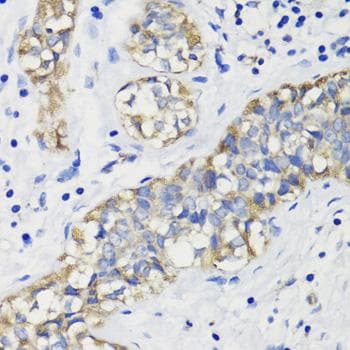 DEPTOR / DEPDC6 Antibody