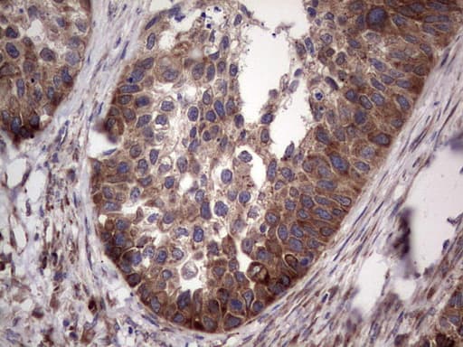 LGALS3 / Galectin 3 Antibody (clone OTI6E1, Carrier-free)