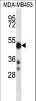 CYP2D6 Antibody (aa76-105)