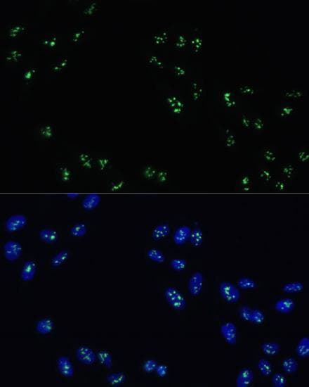 Polyclonal Rabbit anti-Human DDX21 Antibody (IHC, IF)
