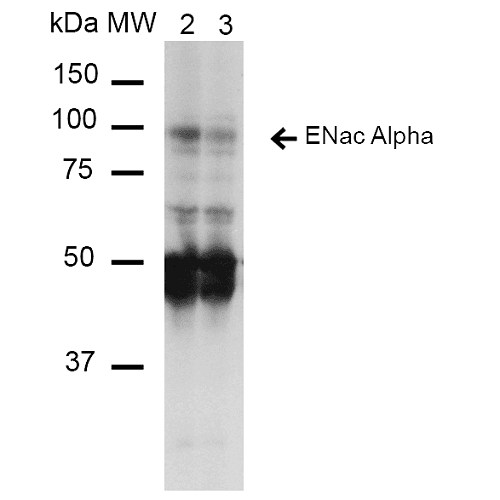 SCNN1A / ENaC Alpha Antibody (clone 14E10)