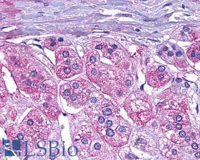 PathPlus™ Polyclonal Rabbit anti-Human GLP1R / GLP-1 Receptor Antibody (N-Terminus, IHC)