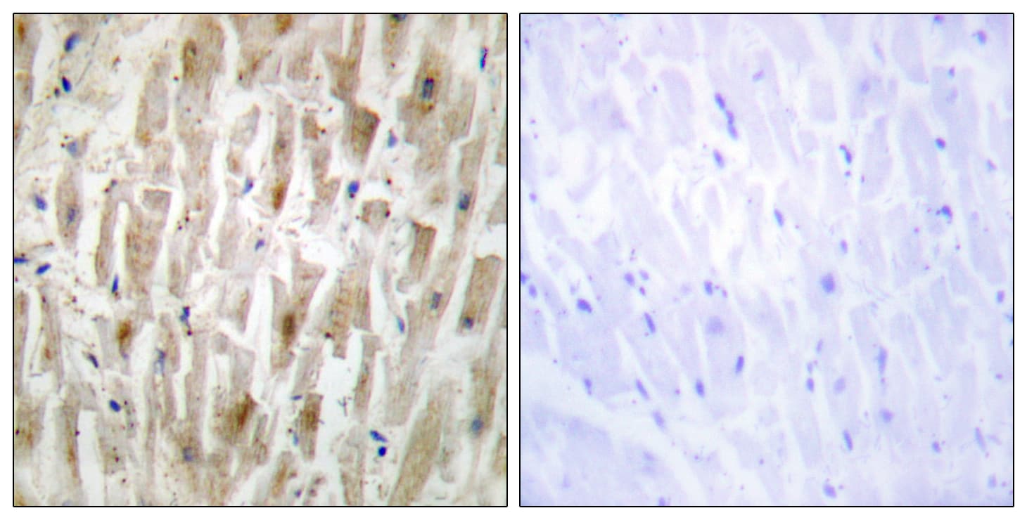 Polyclonal Rabbit anti-Human LIMK2 Antibody (aa461-510, IHC, IF, WB)