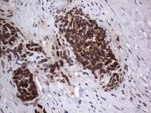 ANO1 / DOG1 / TMEM16A Antibody (aa1-333, clone OTI1C8, Carrier-free)