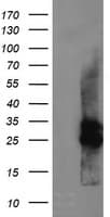 CMPK / CMPK1 Antibody (clone OTI1A1)