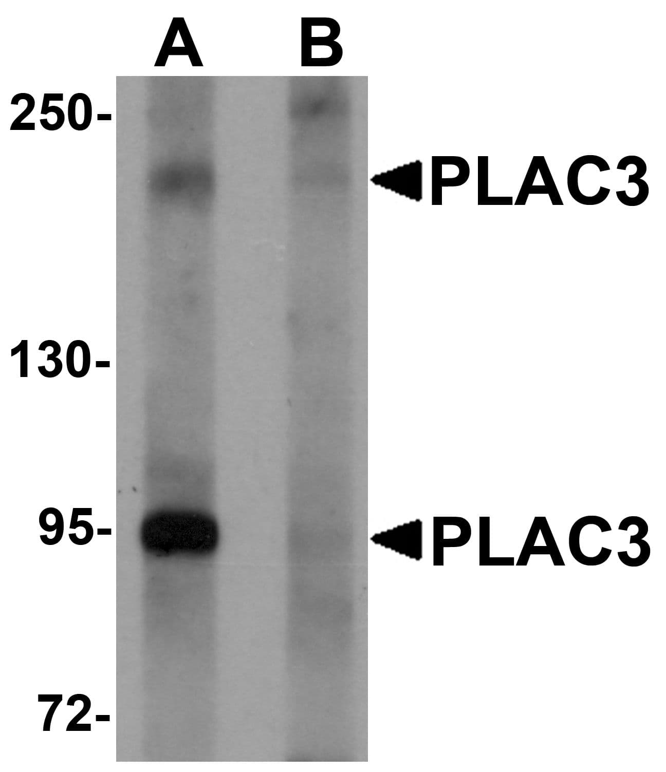 IHC-plus™ PAPPA2 / Pappalysin 2 Antibody
