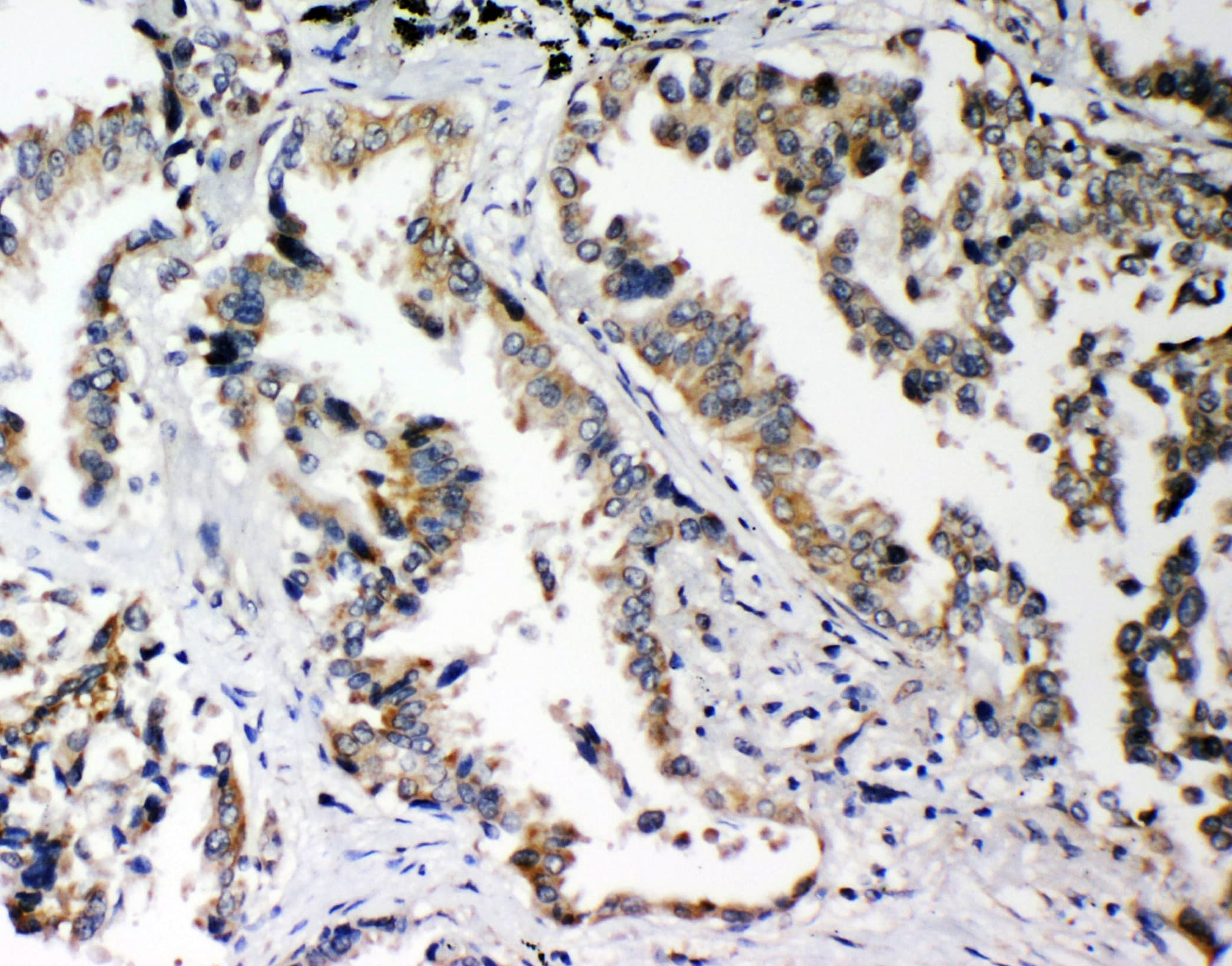 SNK / PLK2 Antibody (aa666-685)