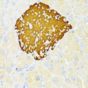 Polyclonal Rabbit anti-Human DDIT3 / CHOP Antibody (IHC, WB)