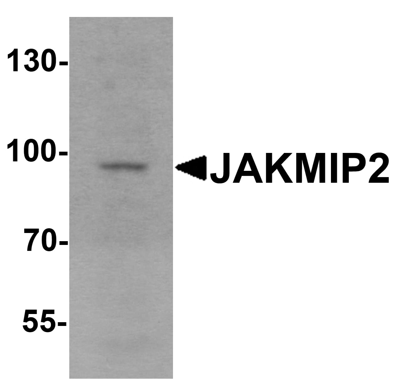 IHC-plus™ JAKMIP2 Antibody