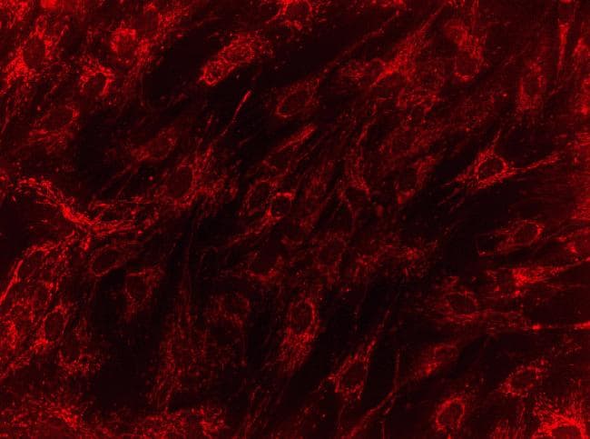 Monoclonal Mouse anti-Human HMGCL Antibody (clone 9F5AB9, IF)