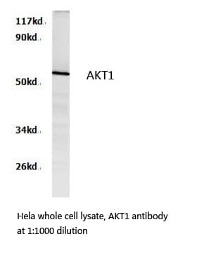 Polyclonal Rabbit anti-Human AKT1 Antibody (WB)