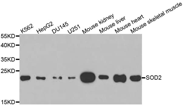 SOD2 / Mn SOD Antibody