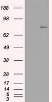 Monoclonal Mouse anti-Human BTK Antibody (clone OTI3D11, IHC, IF, WB)