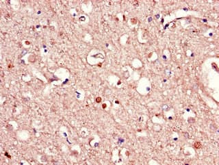 Polyclonal Rabbit anti-Human RAB39B Antibody