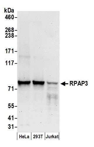 RPAP3 / FLJ21908 Antibody (aa400-450)