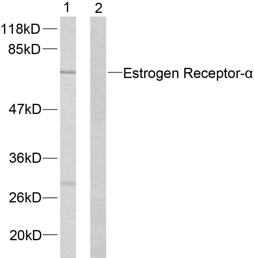 ER Alpha / Estrogen Receptor Antibody (p167)