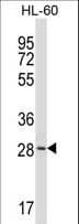 ZDHHC24 Antibody (aa214-241)