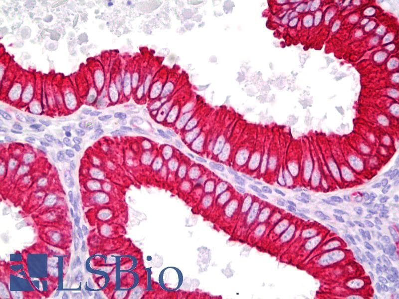 IHC-plus™ Polyclonal Rabbit anti-Human KRT18 / CK18 / Cytokeratin 18 Antibody (aa381-430, IHC, IF, WB)