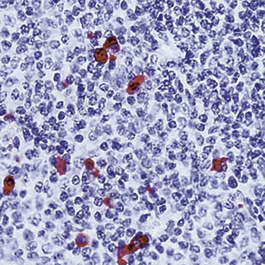 Rabbit Anti-Human IgA Secondary Antibody