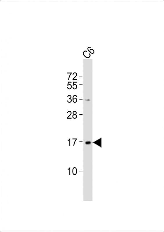 Polyclonal Rabbit anti-Human UBE2N / UBC13 Antibody (aa41-74, WB)