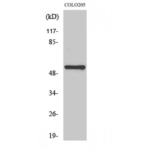 TACR3 / NK3R Antibody (370-450 aa, C-terminal)