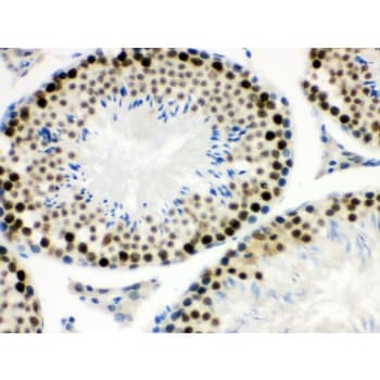 MNAT1 Antibody (aa92-278)