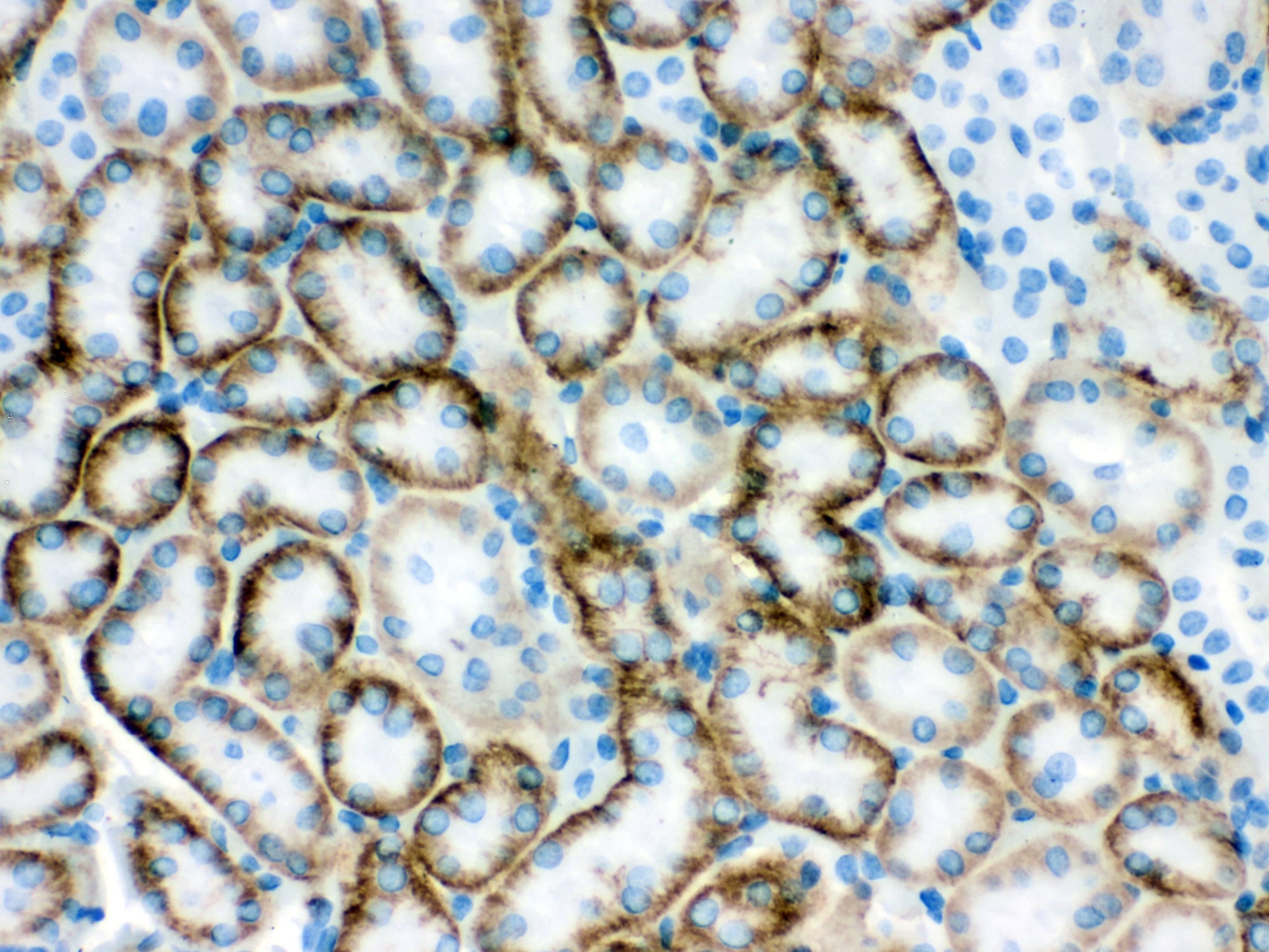 SLC22A2 Antibody (aa524-555)